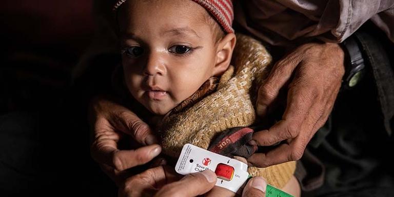 Afghanistan, a baby being assessed for malnutrition at a mobile health clinic Afghanistan, a baby being assessed for malnutrition at a mobile health clinic