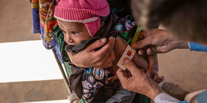 In Afghanistan, a doctor holds a baby who is malnourished due to the ongoing hunger crisis. In Afghanistan, a doctor holds a baby who is malnourished due to the ongoing hunger crisis.