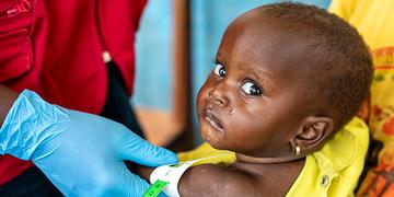 A baby girl looks at the camera while being treated for malnutrition. A baby girl looks at the camera while being treated for malnutrition.