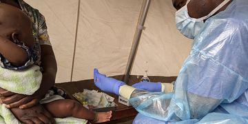 A 5-month-old Mpox Patient Receives Medical Attention in DRC A 5-month-old Mpox Patient Receives Medical Attention in DRC