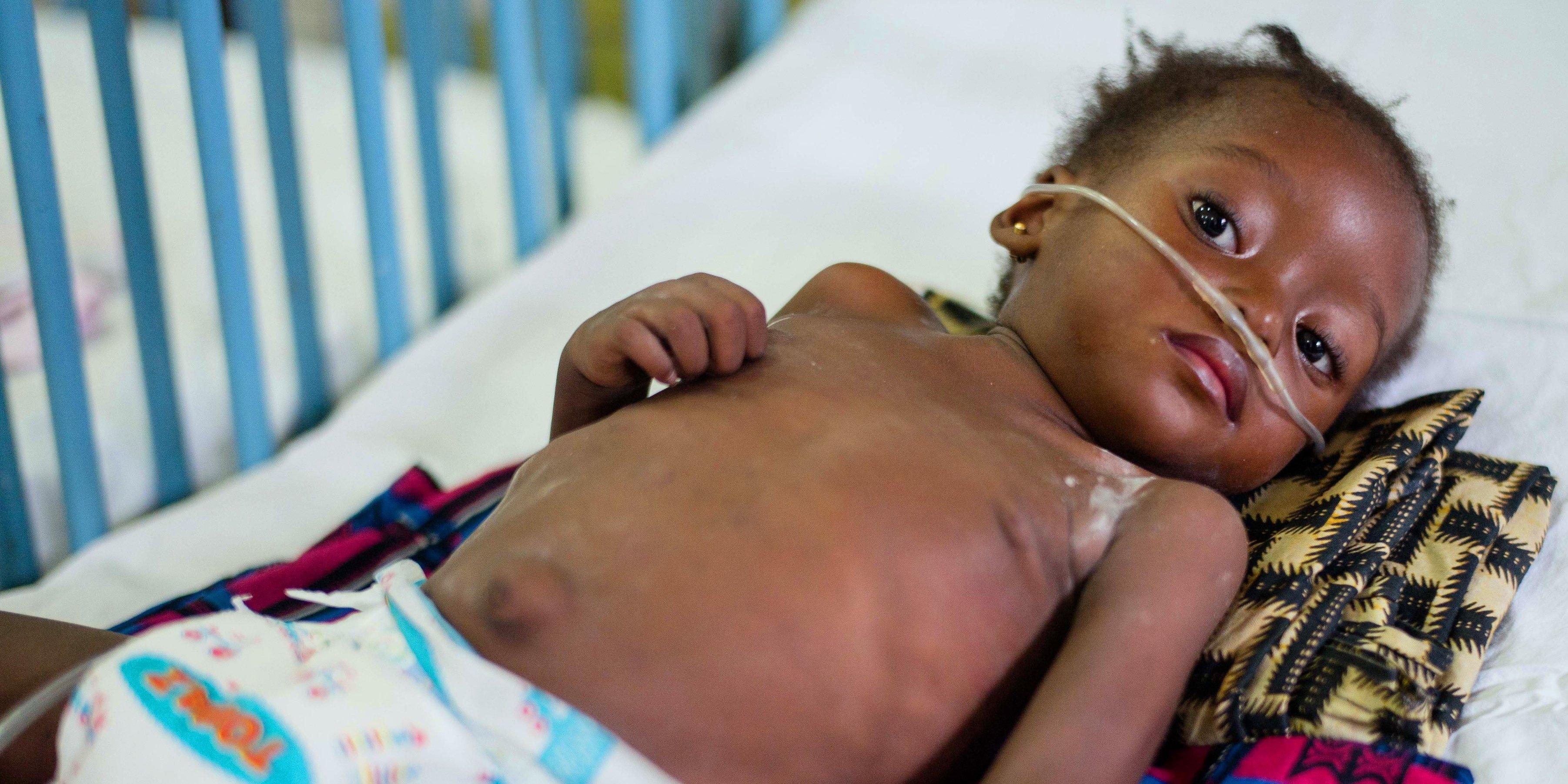 What Is Pneumonia Save The Children What Is Pneumonia Save The Children