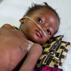 drc-pneumonia-ch1252011-rec.jpg drc-pneumonia-ch1252011-rec.jpg