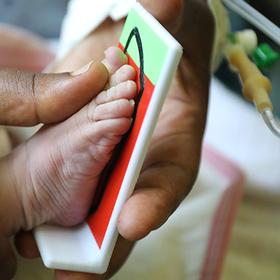 ethiopia-babies-feet-low-birth-weight-ch11238561-rec ethiopia-babies-feet-low-birth-weight-ch11238561-rec