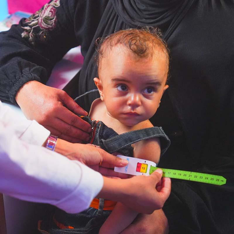 In Gaza, an 18-month old gets screened for malnutrition. 