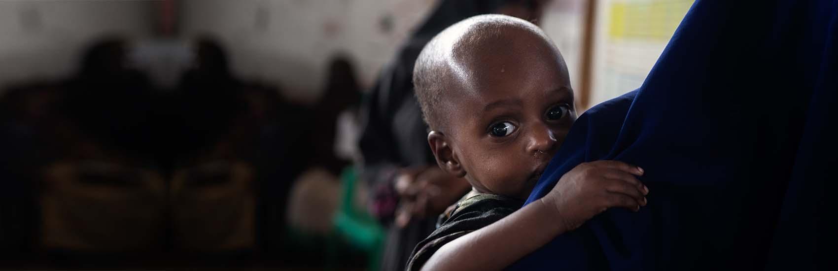 somalia-child-malnutrition-hunger-crisis-ch1752058-hero