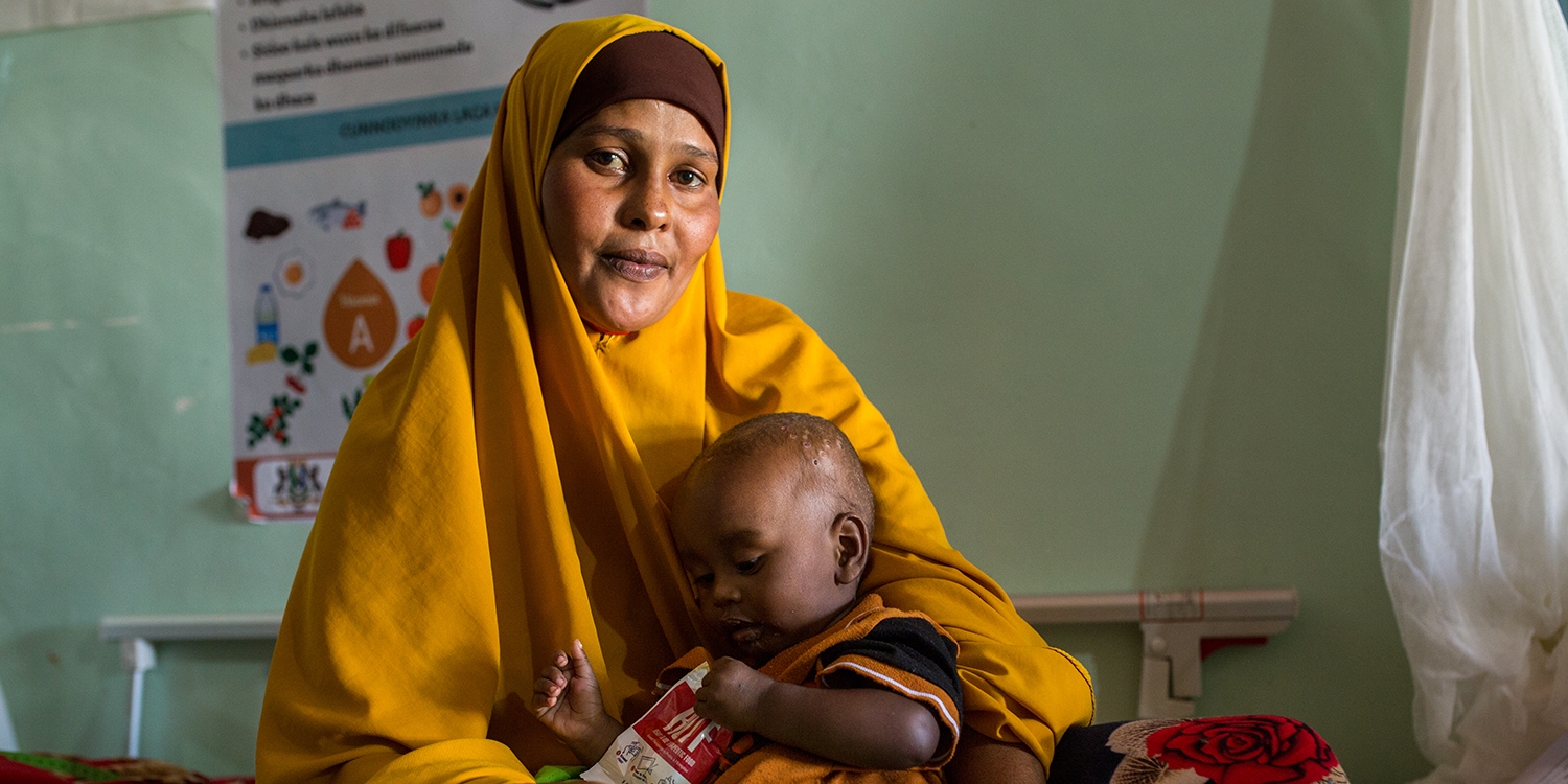Somalia, a 10 month old baby is cradled by his mother after receiving therapeutic food Somalia, a 10 month old baby is cradled by his mother after receiving therapeutic food