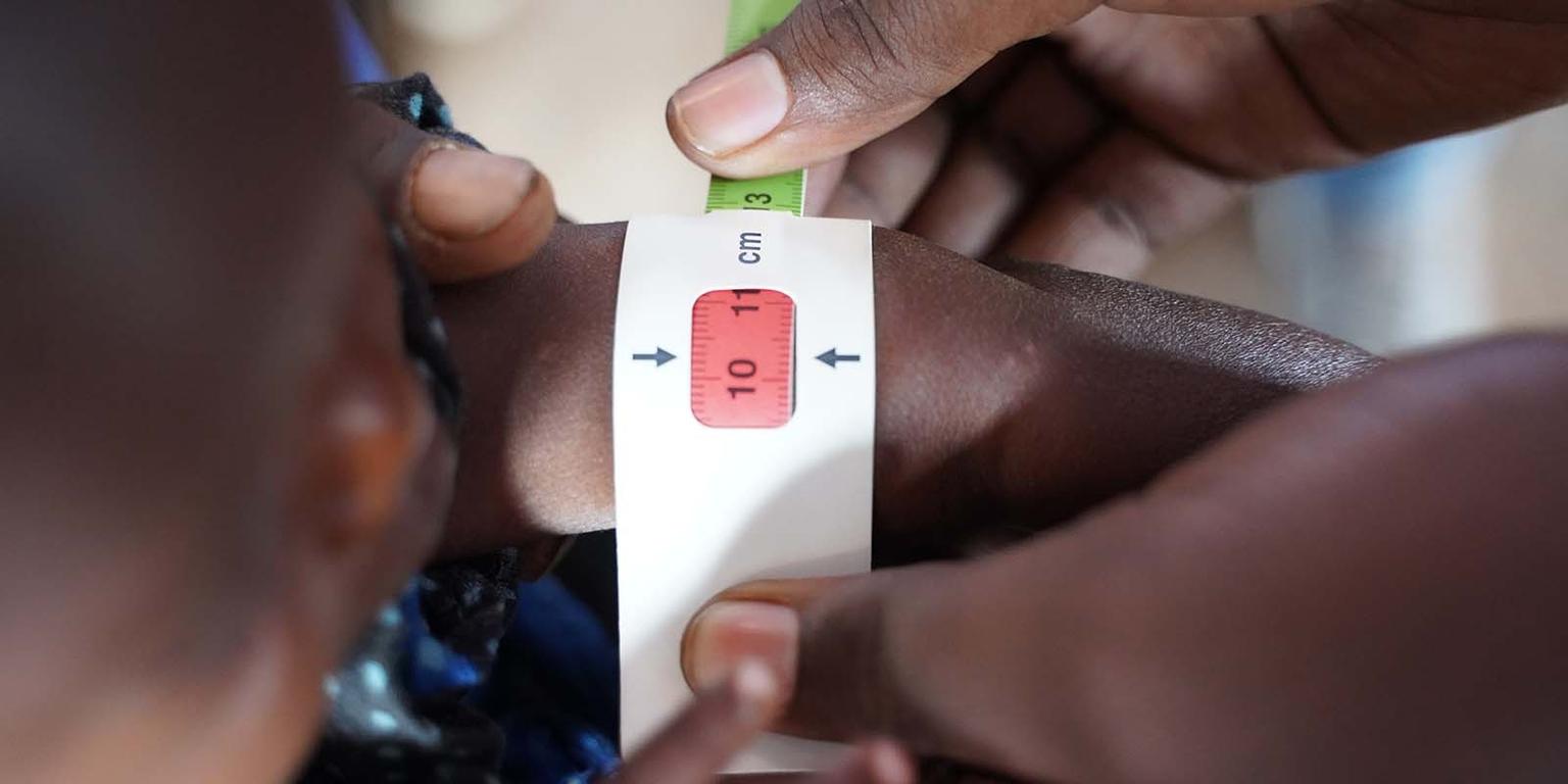 In Somalia, a baby's arm is measured with a MUAC band that is used to diagnose malnutrition. In Somalia, a baby's arm is measured with a MUAC band that is used to diagnose malnutrition.