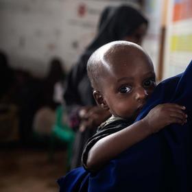 somalia-malnutrition-hunger-crisis-ch1752058-sq somalia-malnutrition-hunger-crisis-ch1752058-sq