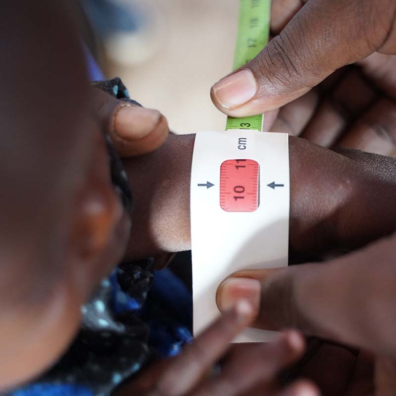 A two-year old child is measured for malnutrition using a MUAC band. A two-year old child is measured for malnutrition using a MUAC band.