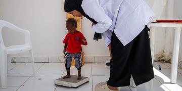 Abdi*, 17 months, standing on a weighing scale in a malnutrition center in Somaliland Abdi*, 17 months, standing on a weighing scale in a malnutrition center in Somaliland