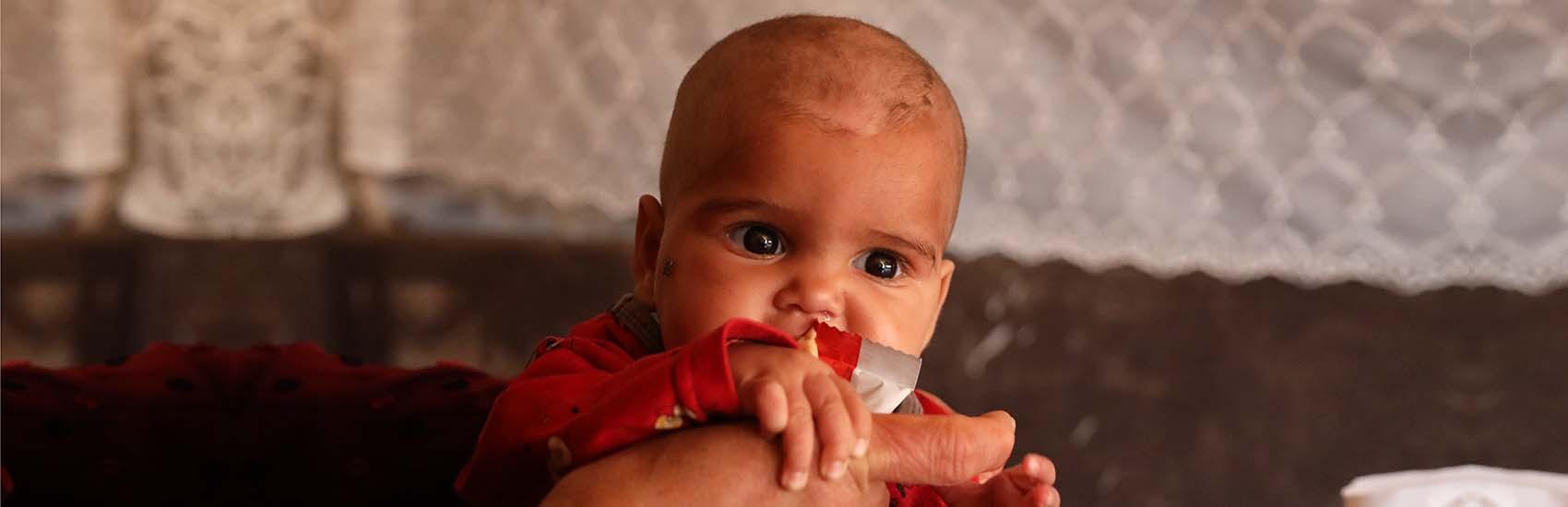 syria-infant-nutrition-treatment-hunger-crisis-ch11086896-hero